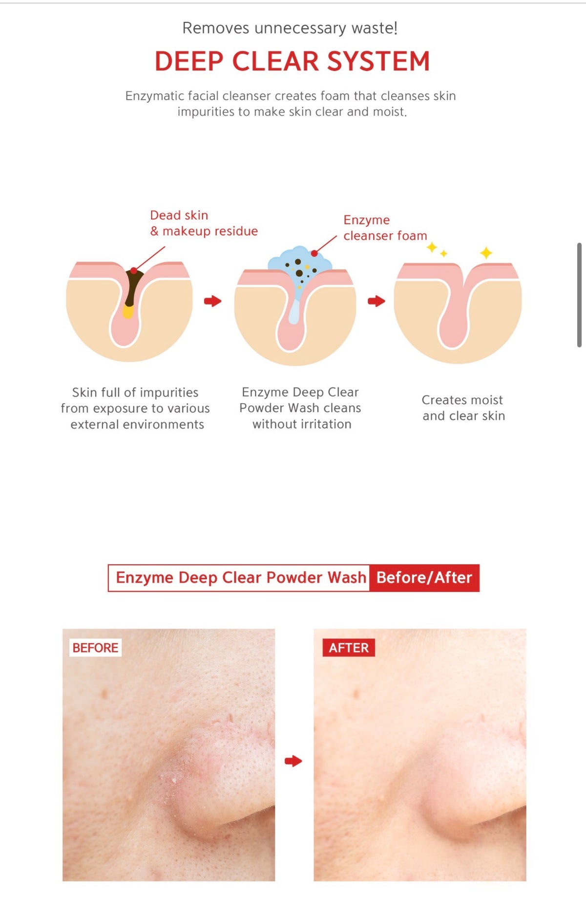 An informational skincare graphic for Enzyme Deep Clear Powder Wash, showing a before-and-after skin diagram with enzyme cleanser foam, plus two small before/after skin close-ups at the bottom.