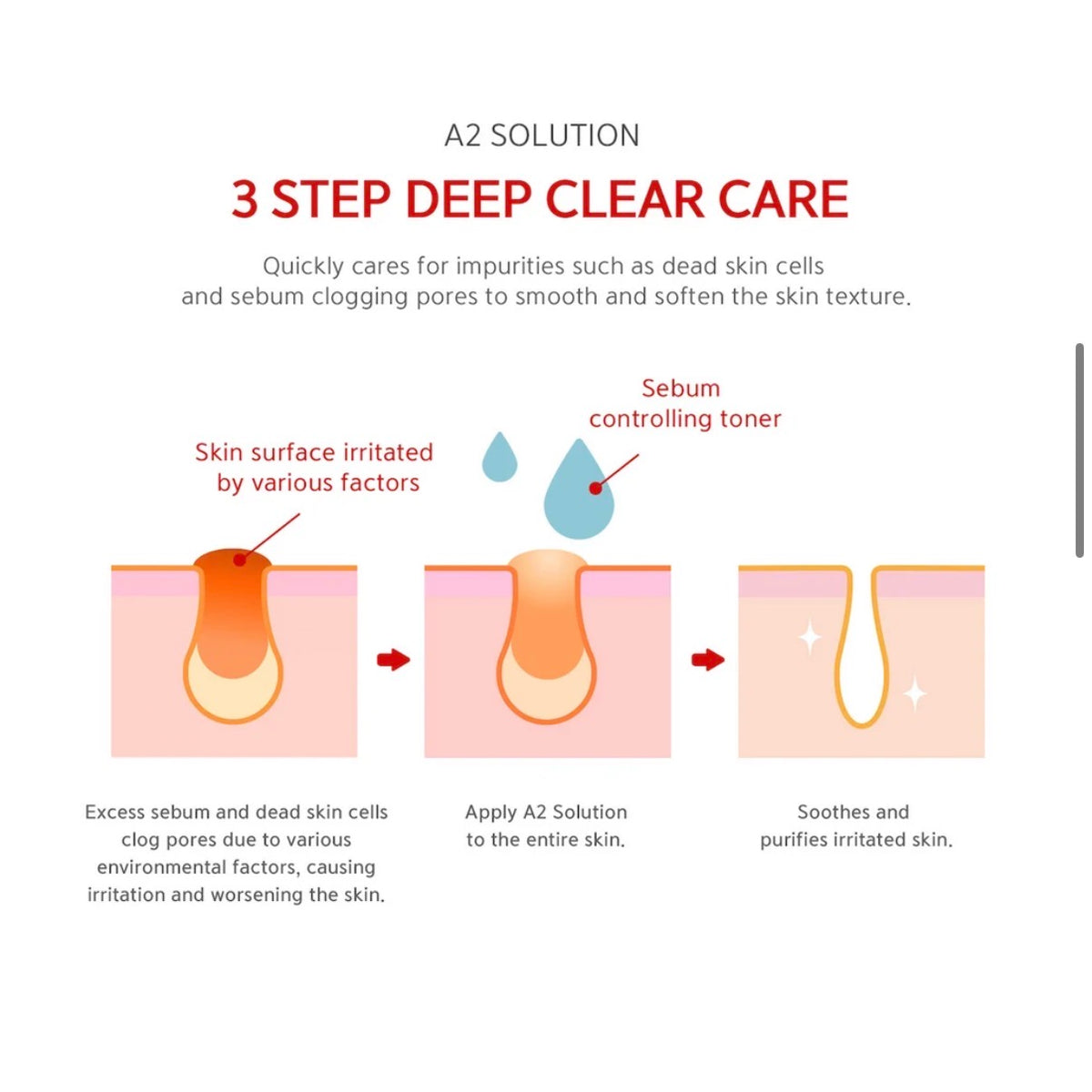 An informational diagram titled 'A2 SOLUTION 3 STEP DEEP CLEAR CARE' showing a three-step illustration of skin care, with labeled panels about irritated skin surface, sebum controlling toner, and soothing purified skin.